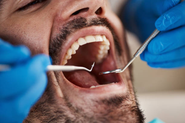 Best Urgent Tooth Repair  in Crescent City, CA